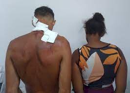 Mãe e padrasto são presos por suspeita de espancar criança de dois anos na BA; vítima tinha olhos roxos e queimaduras de cigarro