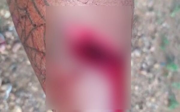 Glória (BA): Mulher é suspeita de esfaquear marido após ler mensagens em celular